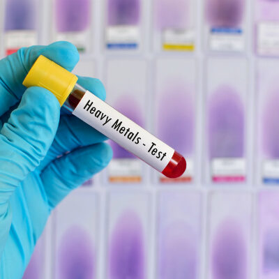 Can Hair Analysis Detect Heavy Metals