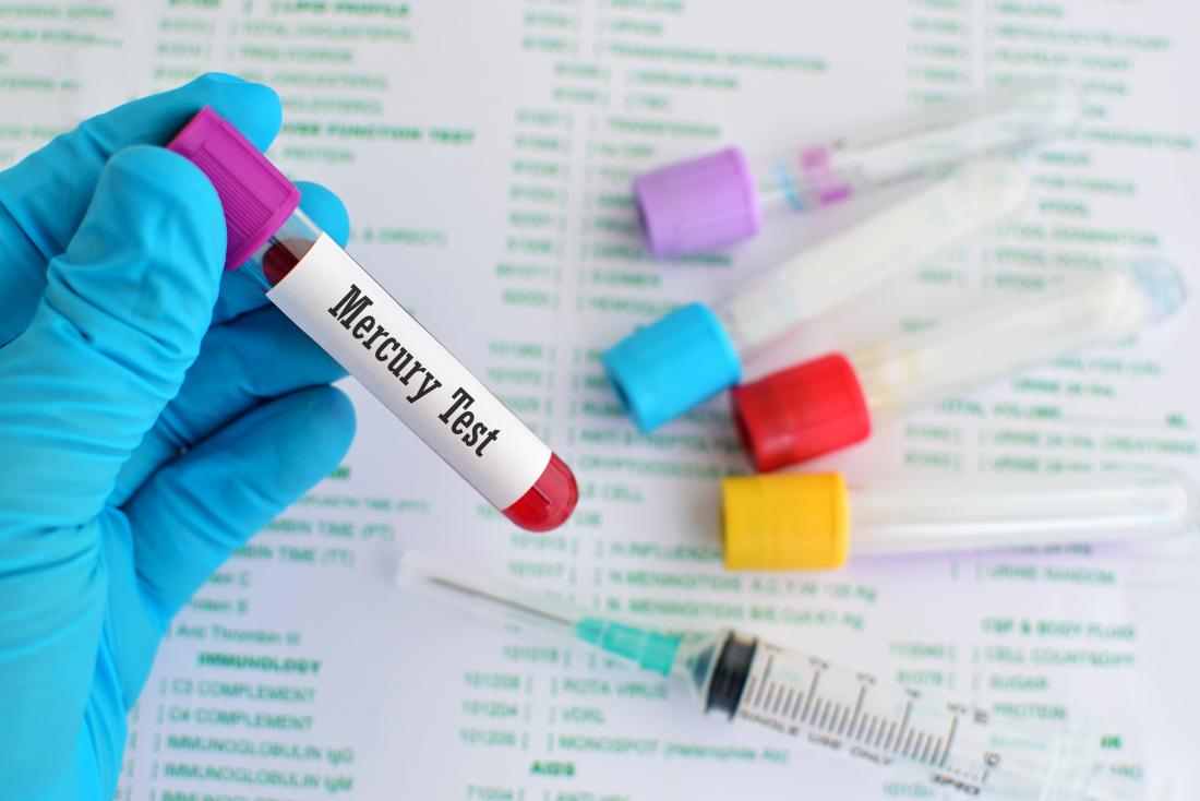 Mercury Toxicity Signs and Testing Guide